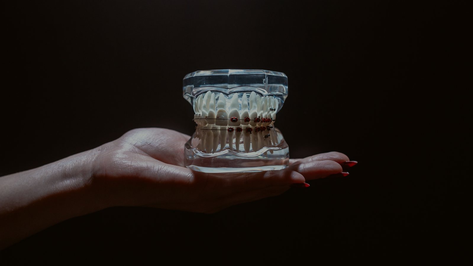 Facetas ou Coroas? A Diferença Que Pode Mudar o Futuro dos Seus Dentes — Instituto AreLuna