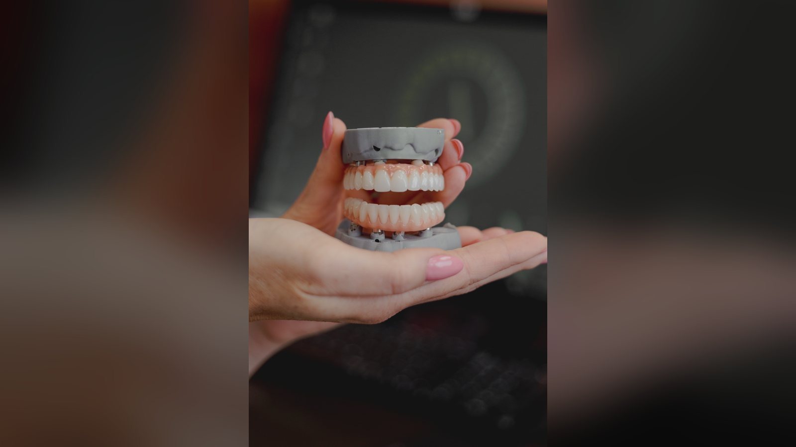 Como Escolher Facetas Dentárias com Segurança: As 10 Perguntas a Fazer Antes de Decidir — Instituto AreLuna