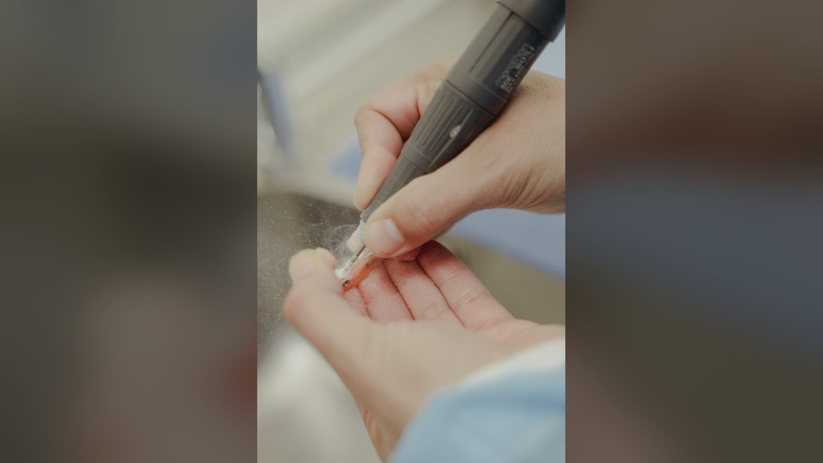 Quanto Custam as Facetas Dentárias? Materiais, Custos e Porque Existem Diferenças de Preço — Instituto AreLuna