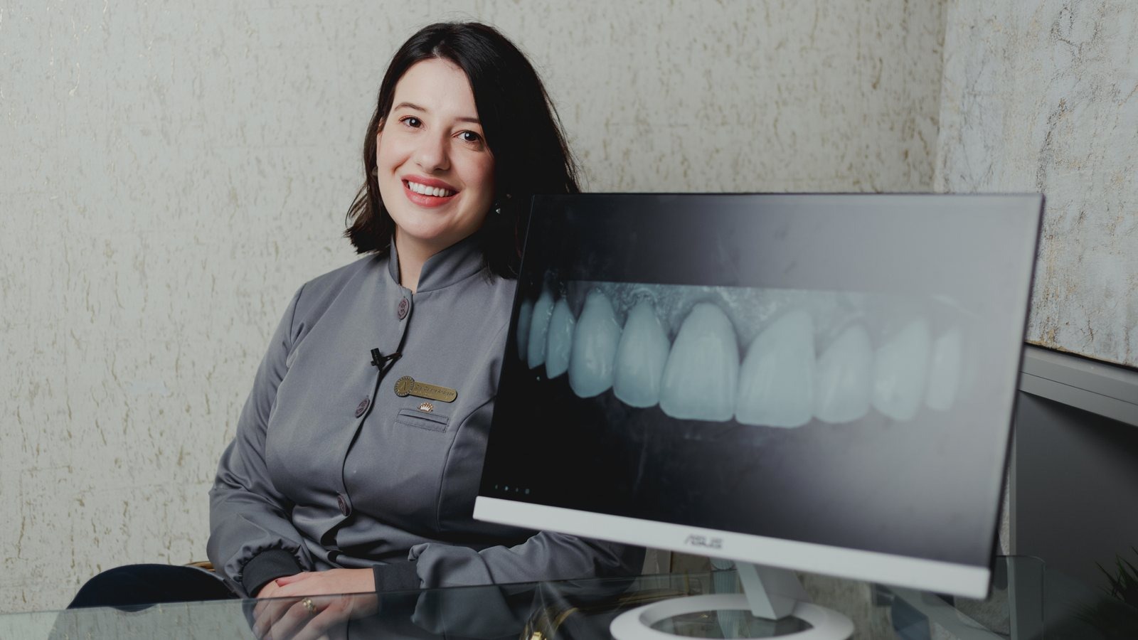 Perguntas Frequentes Sobre Facetas Dentárias (FAQ) — Instituto AreLuna