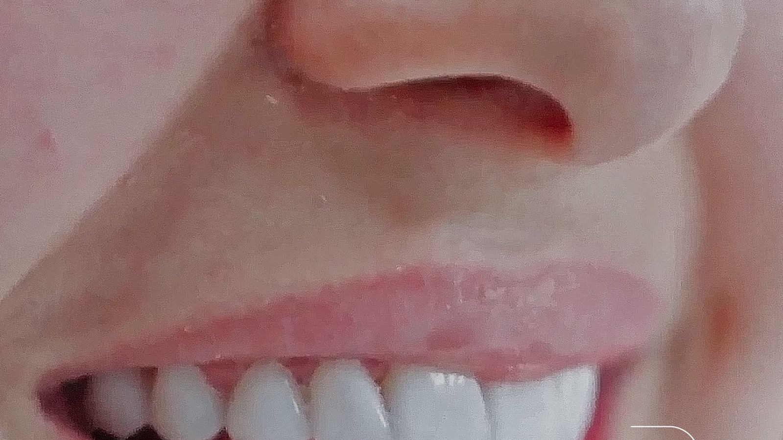 Avaliação do sorriso no Instituto AreLuna